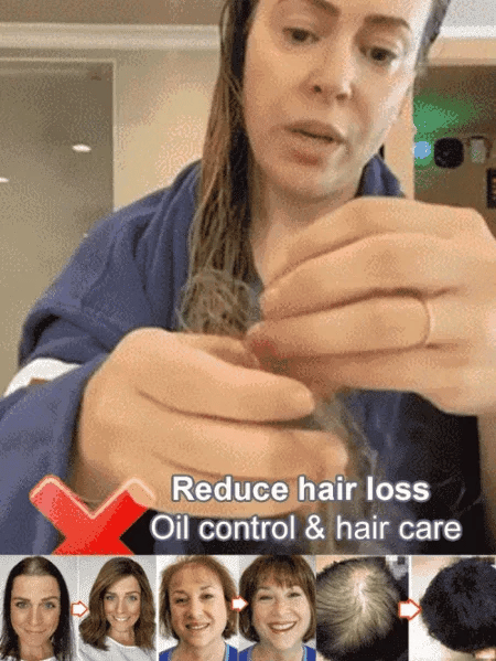 Ginger Plant Extract Anti-Hair Loss Hair Shampoo (PACK OF 4)