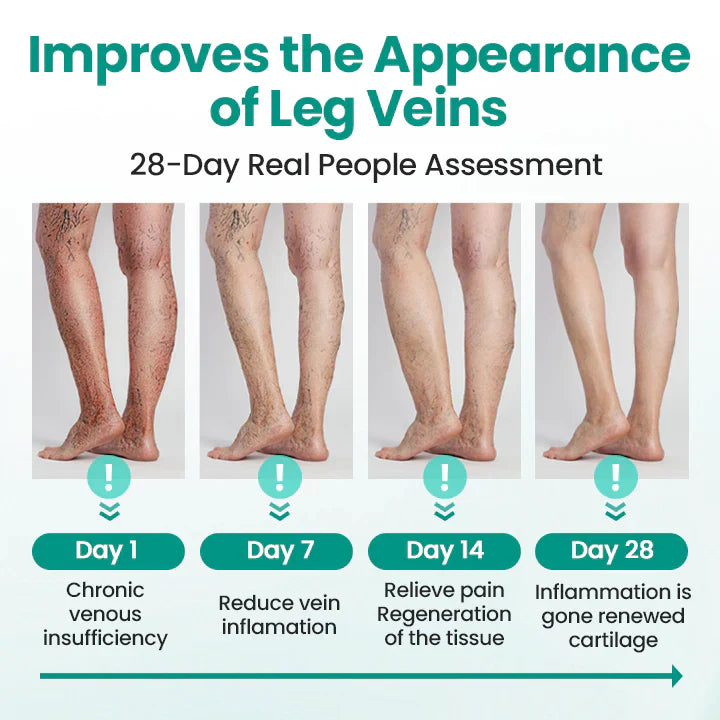 Magnetic Therapy Varicose Veins Patch (PACK OF 20)