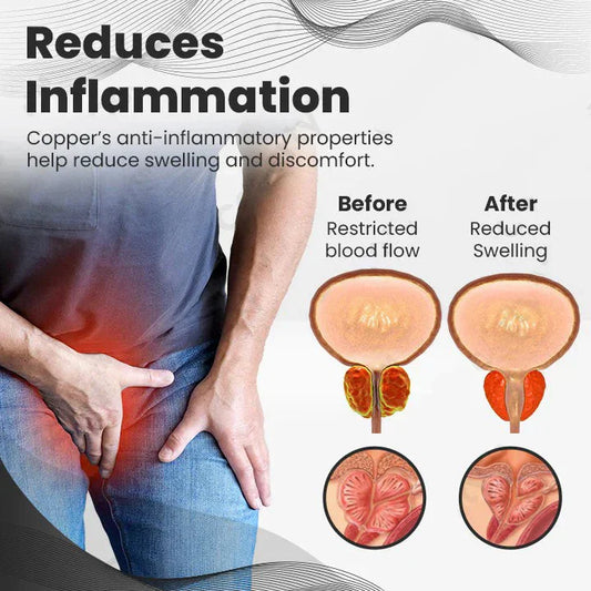 Histone™ CopperMag Prostate Therapy Ring (BUY 1 GET 1 FREE)