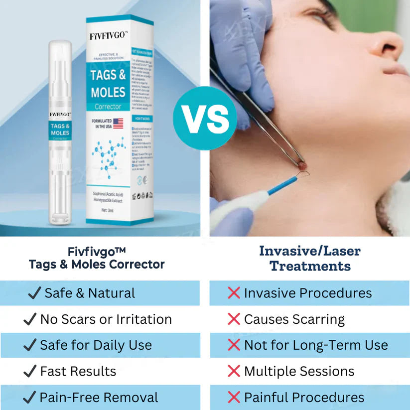 Fivfivgo™ Tags & Moles Remover (FACK OF 2)